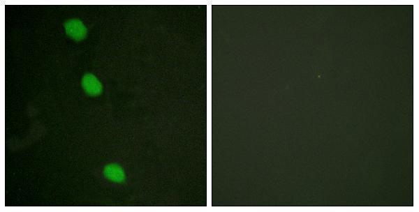 Immunofluorescence analysis of HeLa cells, using CaMK4 (Phospho-Thr196/200) Antibody