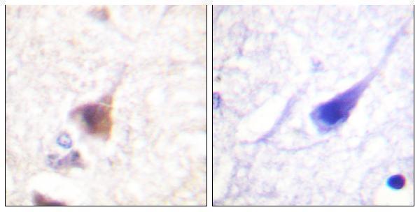 Immunohistochemistry analysis of paraffin-embedded human brain, using CaMK4 (Phospho-Thr196/200) Antibody