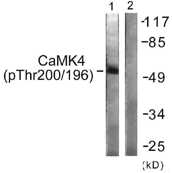 Western blot analysis of lysates from K562 cells treated with H2O2 100uM 30', using CaMK4 (Phospho-Thr196/200) Antibody