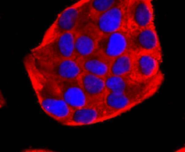a01906 3 pdha1 primary antiboties icc testing 2