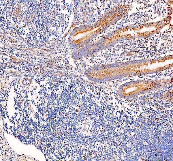 a01906 4 pdh e1 alpha pdha1 primary antibodies ihc testing 2