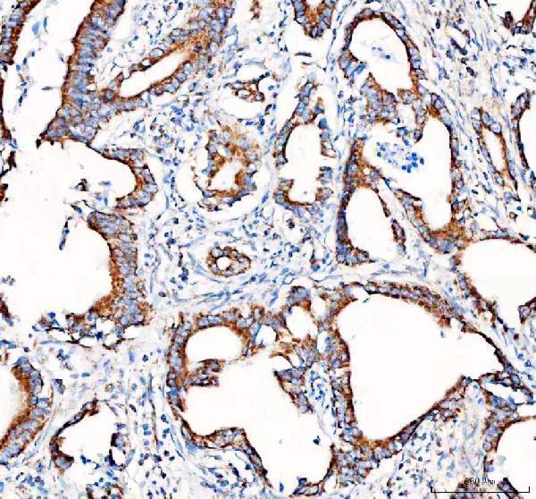 a01906 4 pdh e1 alpha pdha1 primary antibodies ihc testing 3