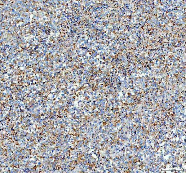 a01906 4 pdh e1 alpha pdha1 primary antibodies ihc testing 4