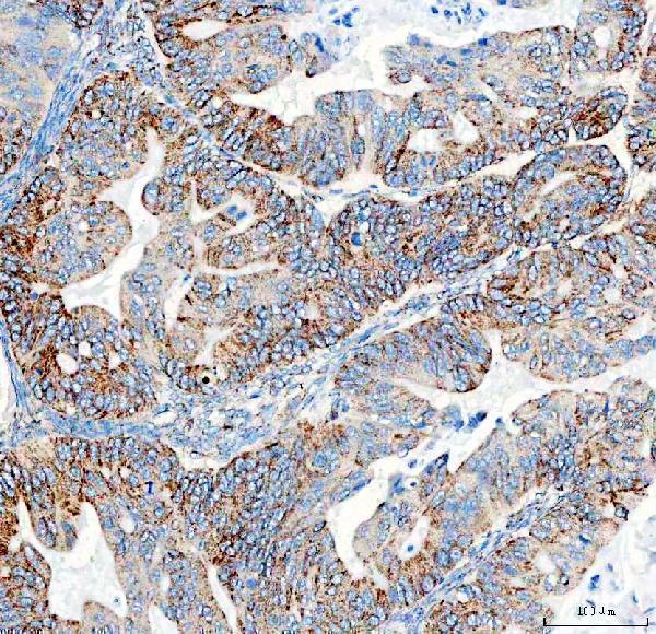 a01906 4 pdh e1 alpha pdha1 primary antibodies ihc testing 6