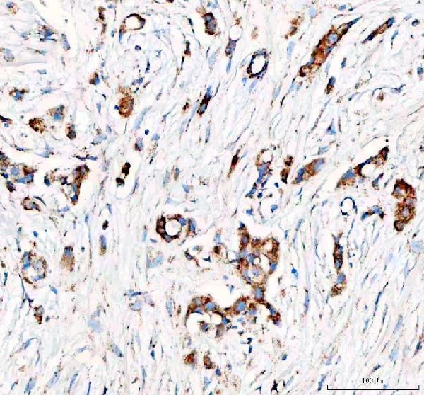 a01906 4 pdh e1 alpha pdha1 primary antibodies ihc testing 7