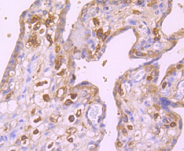 Immunohistochemical analysis of paraffin-embedded human placenta tissue using anti-GABARAP antibody