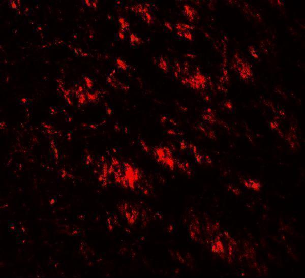 Immunofluorescence of GABARAP in human brain tissue with GABARAP antibody at 20 μg/ml