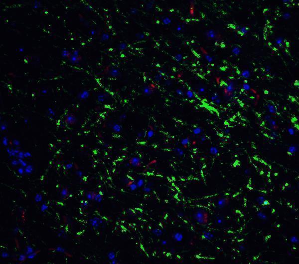a01907 gabarap primary antibodies if testing 4