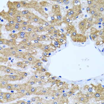 a01908 ccm2 primary antiboties ihc testing 2