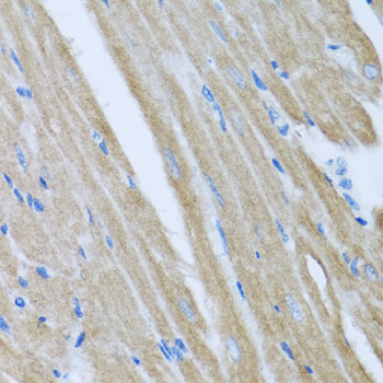 a01908 ccm2 primary antiboties ihc testing 4
