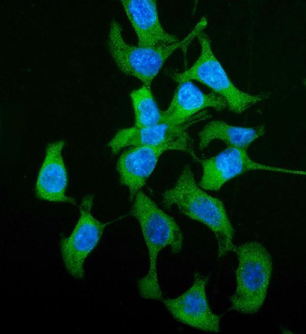a01909 1 hgd primary antibody if testing 4