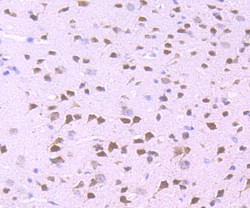 Immunohistochemical analysis of paraffin-embedded mouse brain tissue using anti-WDR5 antibody
