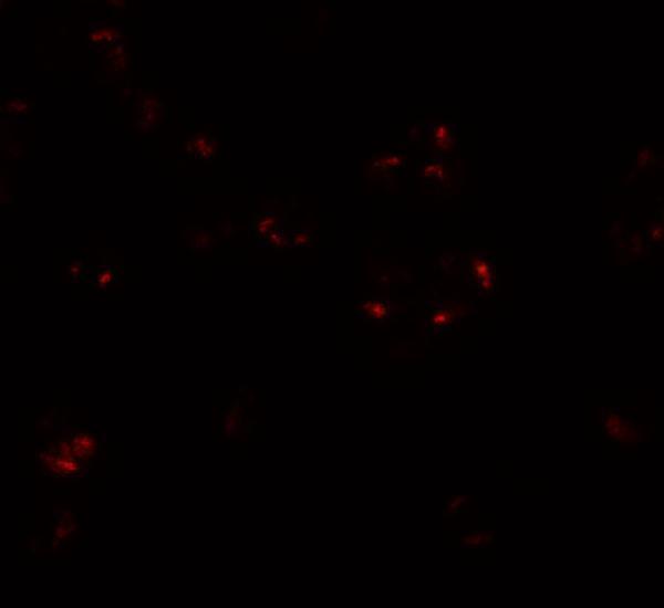 a01910 wdr5 primary antibodies if testing 3