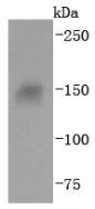 Western blot analysis of Integrin alpha 5 on Hela cells lysates using anti-Integrin alpha 5 antibody at 1/1,000 dilution