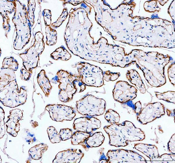  IHC analysis of ITGA5 using anti-ITGA5 antibody (A01911)