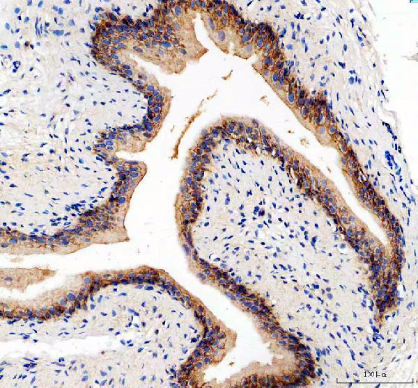  IHC analysis of ITGA5 using anti-ITGA5 antibody (A01911)