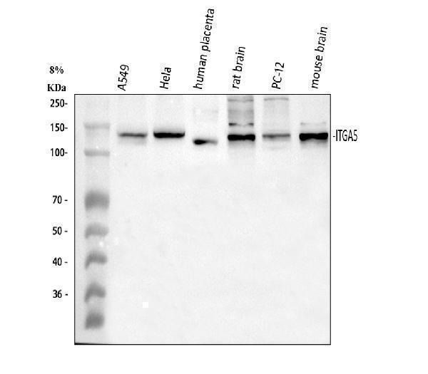  Western blot analysis of ITGA5 using anti-ITGA5 antibody (A01911)