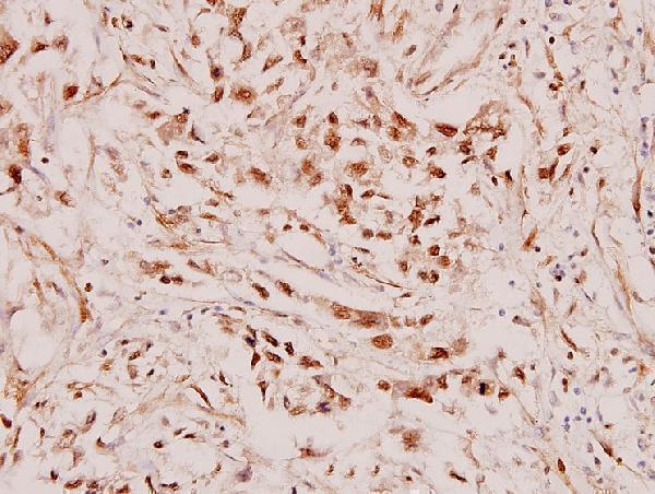 a01912 rarb primary antiboties ihc testing 2