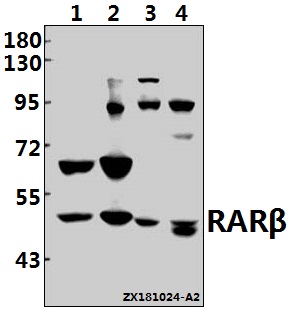 a01912 rarb primary antiboties wb testing 1