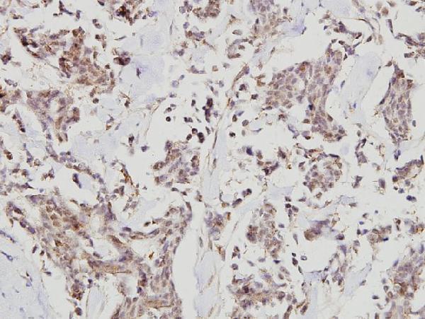 a01913 1 hdac7 primary antiboties ihc testing 2