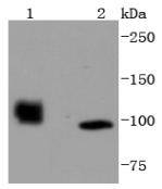 Western blot analysis of HDAC7 on different lysates using anti-HDAC7 antibody at 1/1,000 dilution