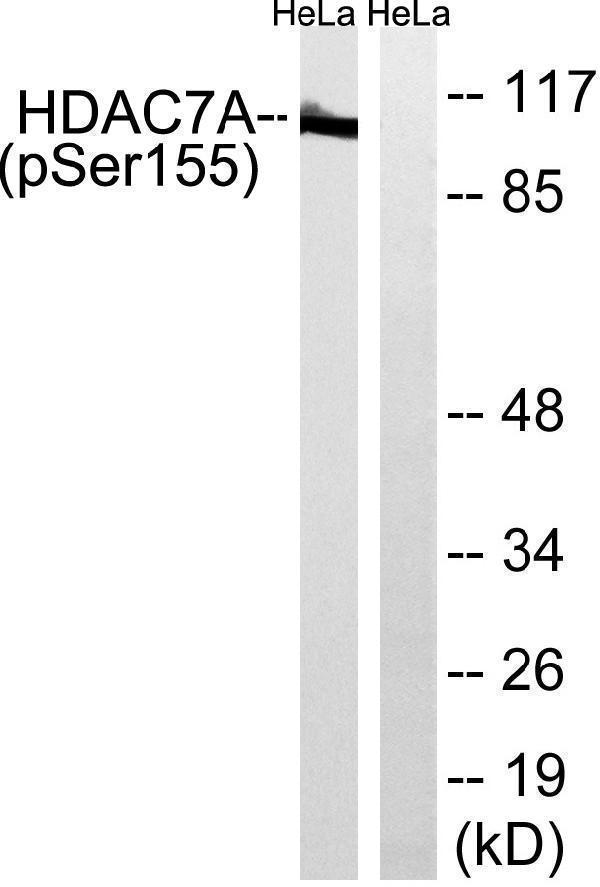 Western blot analysis of lysates from HeLa cells, using HDAC7A (Phospho-Ser155) Antibody