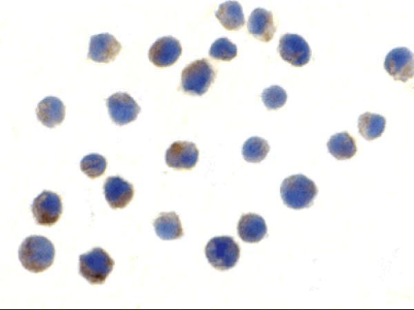 Immunocytochemistry of TLR6 in Jurkat cells with TLR6 antibody at 10 μg/mL