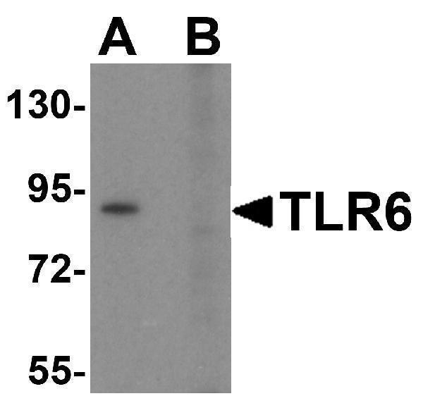Western blot analysis of TLR6 in Daudi cell lysate with TLR6 antibody at 1 μg/mL in (A) the absence and (B) the presence of blocking peptide