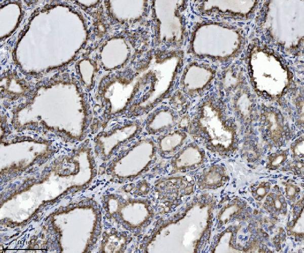  IHC analysis of SCA2/ATXN2 using anti-SCA2/ATXN2 antibody (A01915)