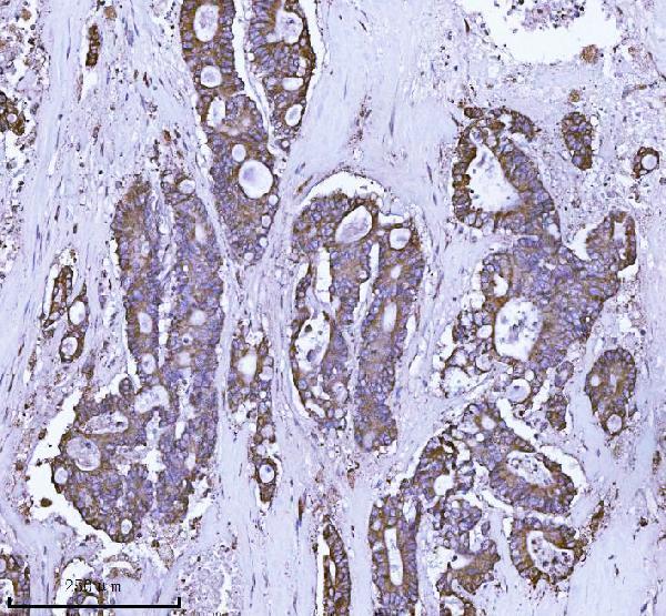 IHC analysis of SCA2/ATXN2 using anti-SCA2/ATXN2 antibody (A01915)