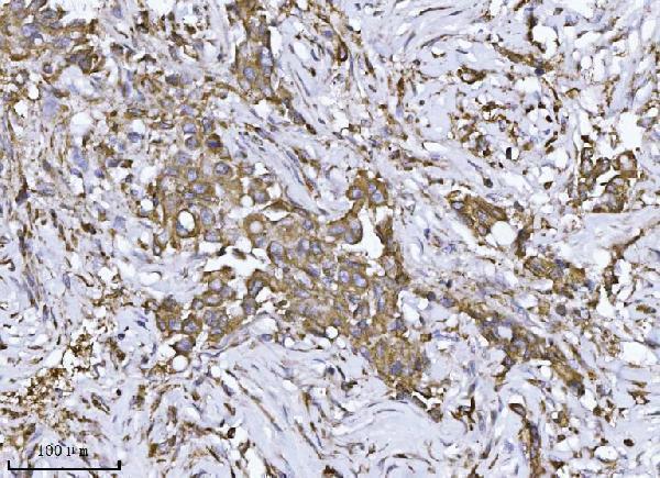 a01915 atxn2 primary antibodies ihc testing 5