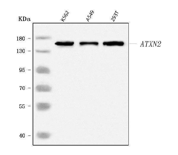  Western blot analysis of SCA2/ATXN2 using anti-SCA2/ATXN2 antibody (A01915)