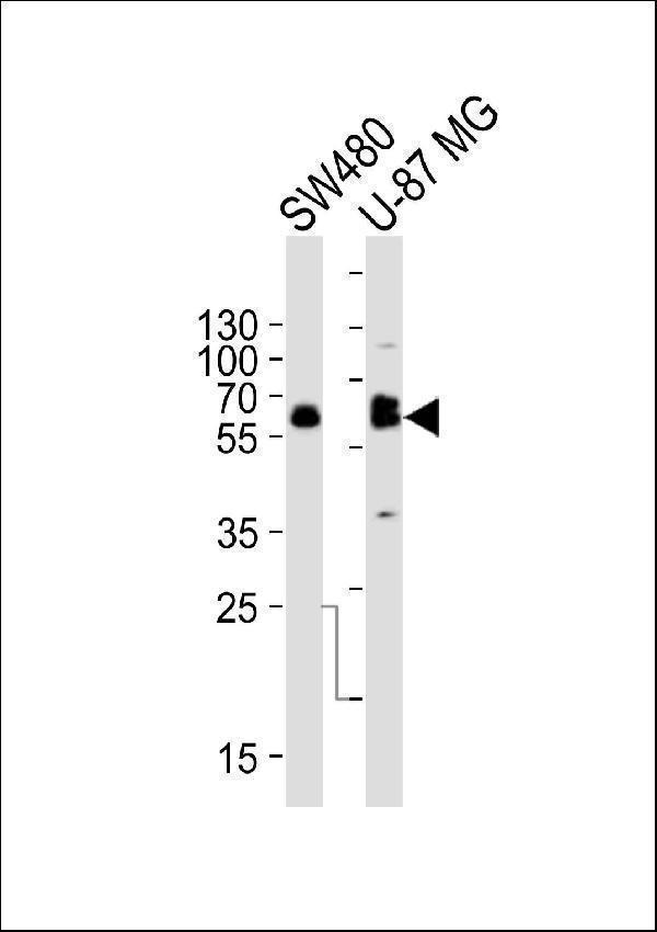 Western blot analysis of lysates from SW480, U-87 MG cell line (from left to right), using TH Antibody (C-term)