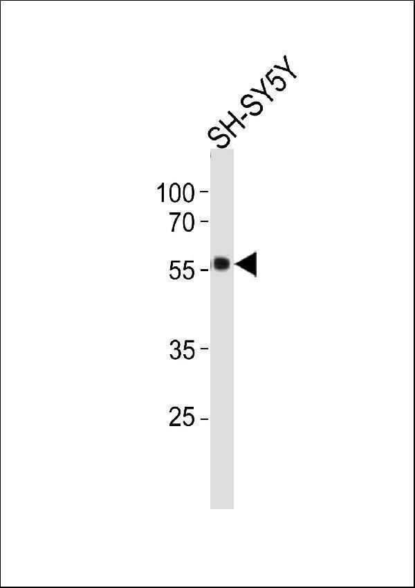TH Antibody (C-term) (Cat