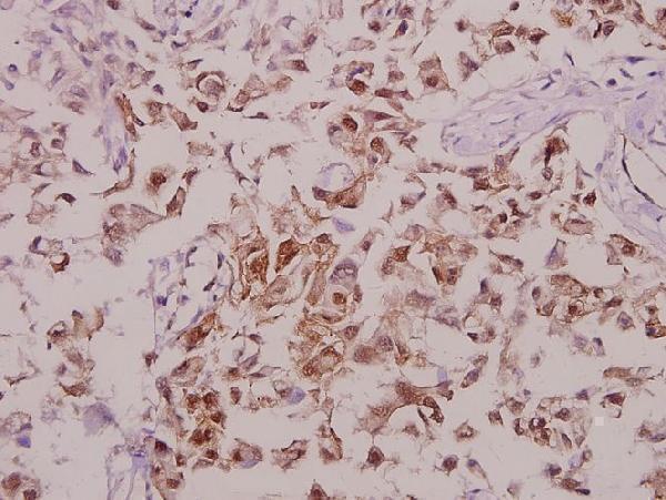 a01917s71 th primary antiboties ihc testing 2