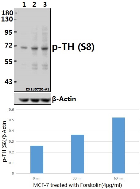 a01917s8 th primary antiboties wb testing 1