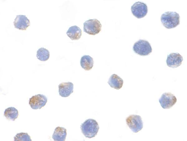 Immunocytochemistry of IKK alpha in Jurkat cells with IKK alpha antibody at 1μg/mL