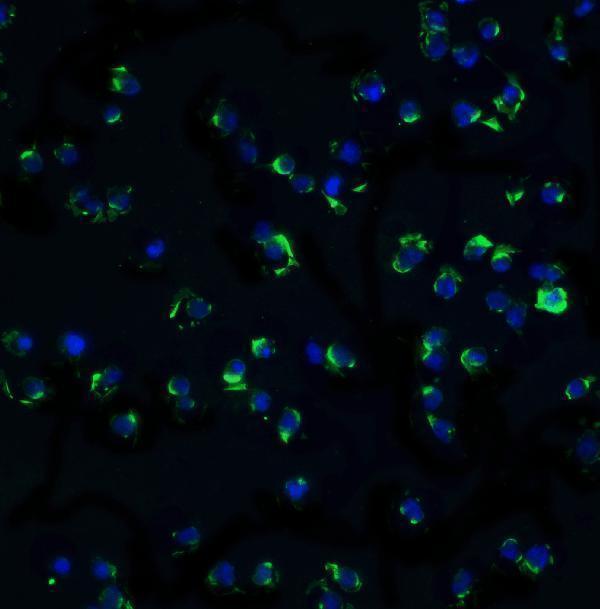 a01918 chuk primary antibodies if testing 4