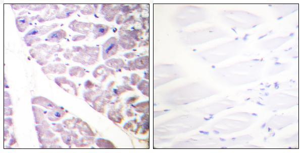 Immunohistochemistry analysis of paraffin-embedded human heart, using IKK-alpha (Phospho-Ser176) /IKK-beta (Phospho-Ser177) Antibody