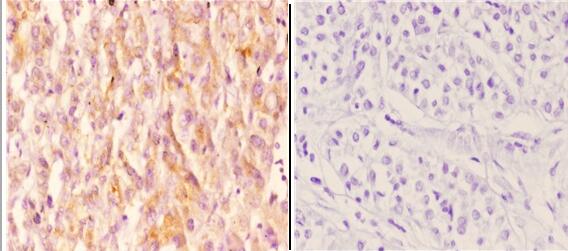 a01918s176 chuk primary antiboties ihc testing 4