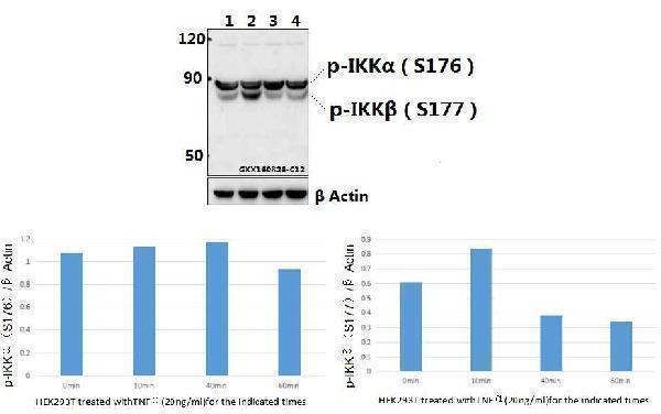 Western blot (WB) analysis of IKKα/β (phospho-S176/177) polyclonal antibody at 1:500 dilution
Lane1:HEK293T whole cell lysate
Lane2:HEK293T treated with TNFα(20ng/ml)for 10 minutes whole cell lysate
Lane3:HEK293T treated with TNFα(20ng/ml)for 40 minutes whole cell lysate
Lane4:HEK293T treated with TNFα(20ng/ml)for 1 hour whole cell lysate