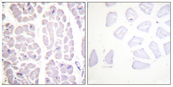 Immunohistochemistry analysis of paraffin-embedded human heart, using IKK-alpha/beta (Phospho-Ser180/181) Antibody