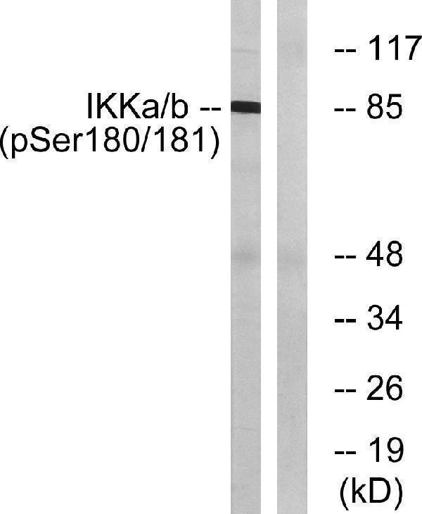Western blot analysis of lysates from HepG2 cells treated with TNF 20ng/ml 5', using IKK-alpha/beta (Phospho-Ser180/181) Antibody