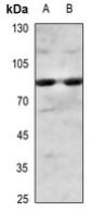 Western blot analysis of IKK alpha/beta (Phospho-S180/181) expression in mouse testis (A), rat testis (B) whole cell lysates