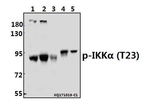 Western blot (WB) analysis of IKKα (phospho-T23) polyclonal antibody at 1:500 dilution
Lane1:K562 whole cell lysate(40ug)
Lane2:HepG2 whole cell lysate(40ug)
Lane3:HEK293T whole cell lysate(40ug)
Lane4:The Embryo tissue lysate of Rat(10ug)
Lane5:The Brain tissue lysate of Mouse(40ug)