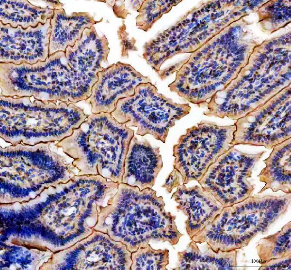a01919 1 nmu primary antibodies ihc testing 1