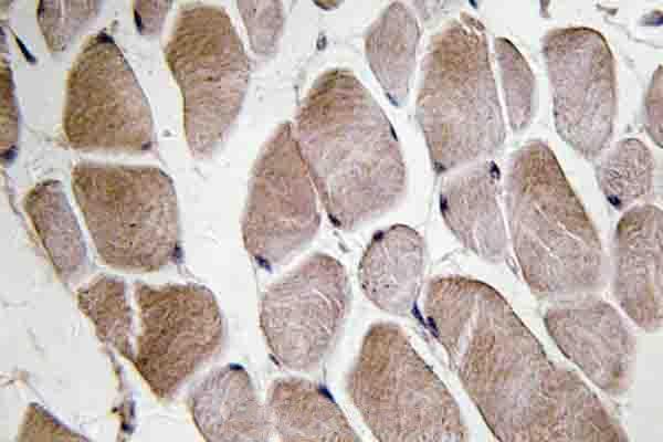 a01919 2 nmu primary antiboties ihc testing 2