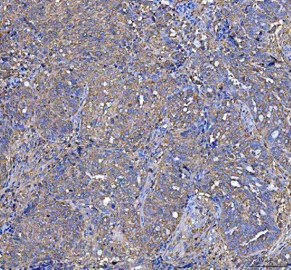  IHC analysis of LAP3 using anti-LAP3 antibody (A01921-1)