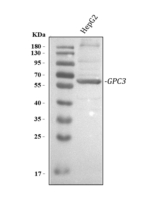 a01922 2 gpc3 primary antibodies wb testing 1