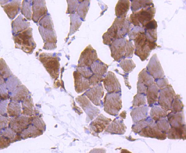 Immunohistochemical analysis of paraffin-embedded rat skeletal muscle tissue using anti-Plectin antibody